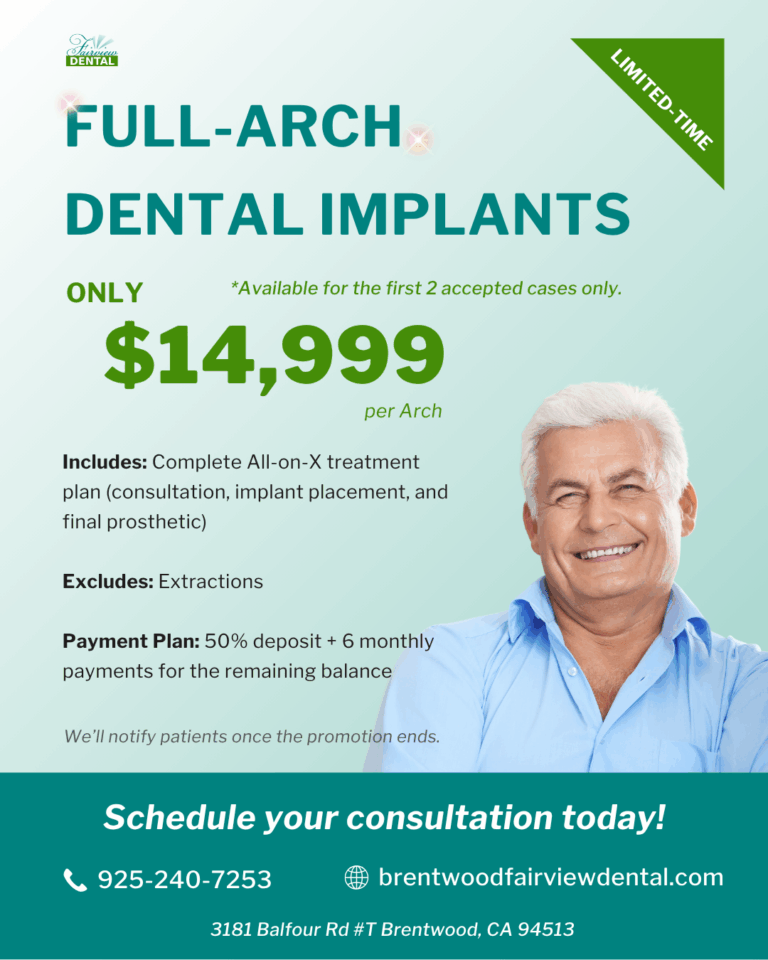 Full arch dental implants All-on-X special offer at Fairview Dental in Brentwood