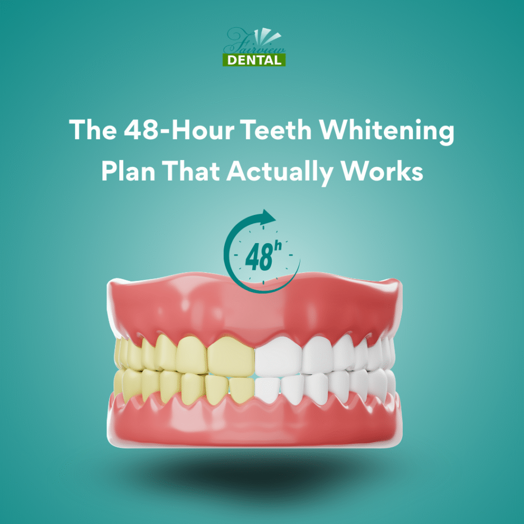A 3D dental model showing a half-yellow and half-white smile, illustrating the 48-hour professional teeth whitening results available at Fairview Dental in Brentwood, CA.